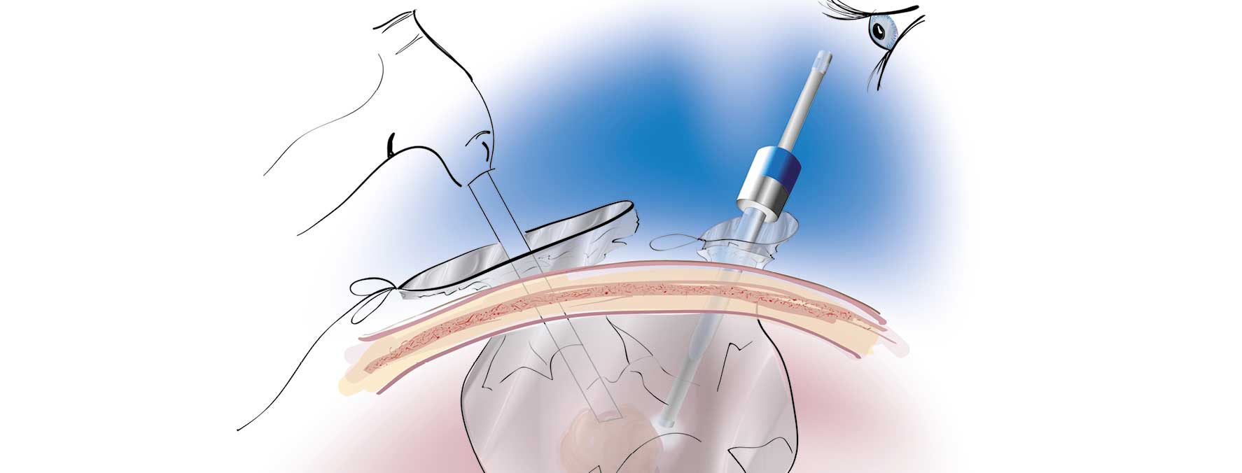 medizinische Illustration
